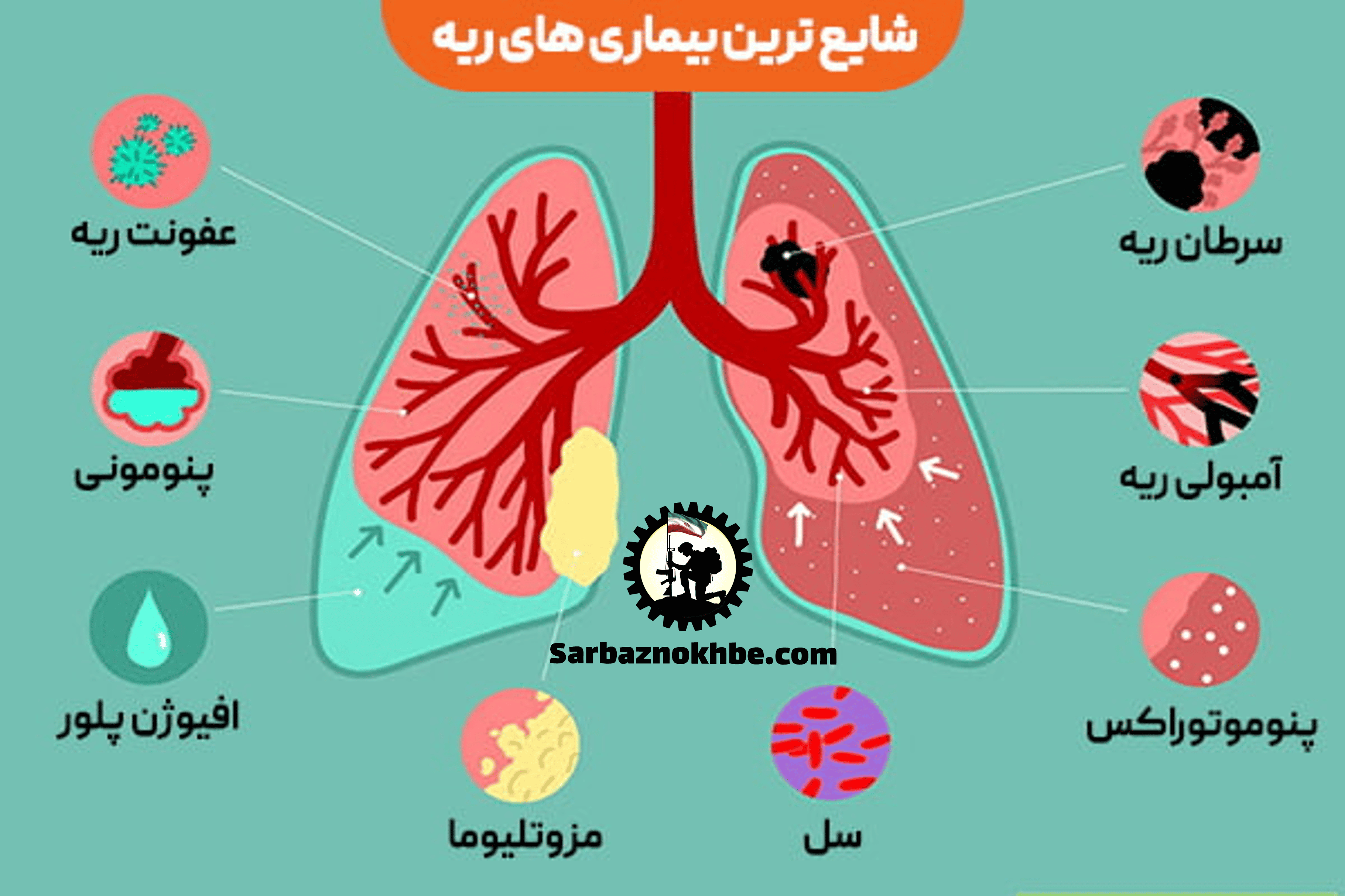 بیماری‌های ریه و قفسه سینه