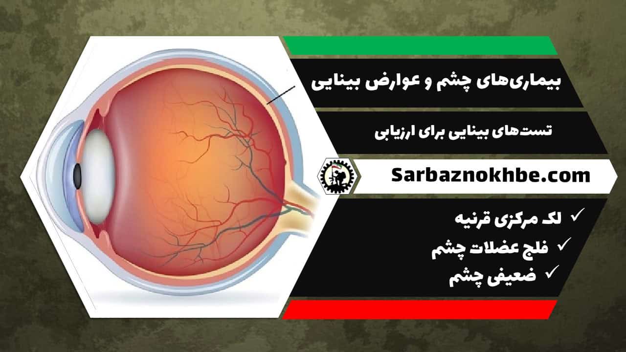 بیماری‌های چشم و عوارض بینایی