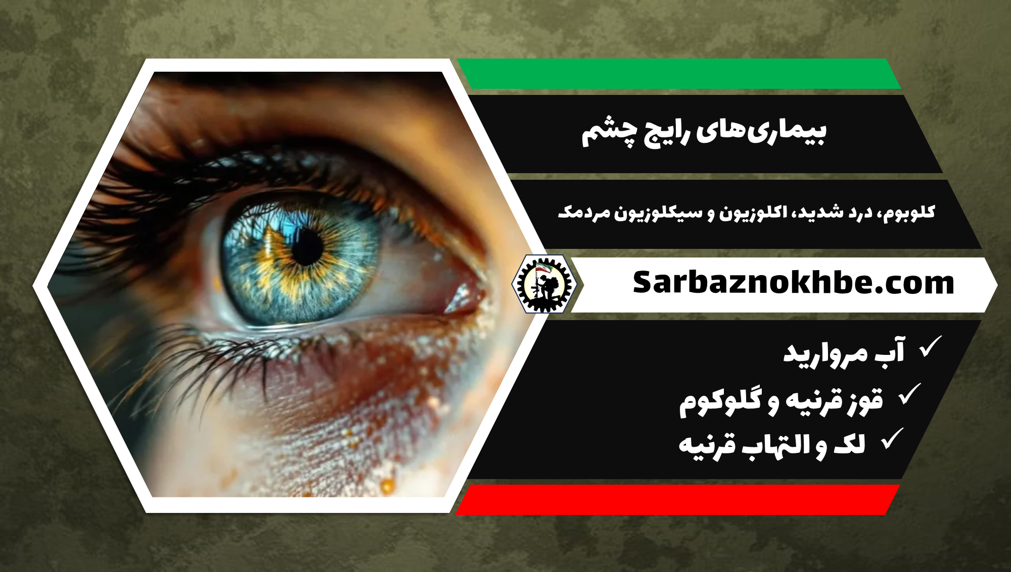 بیماری‌های رایج برای معافیت چشم