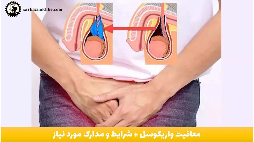 معافیت واریکوسل سربازی ۱۴۰۵ + شرایط و مدارک مورد نیاز