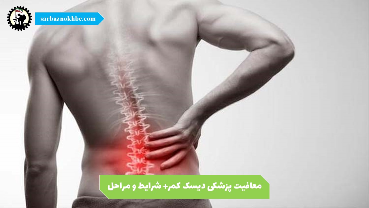 معافیت پزشکی دیسک کمر؛ شرایط، مدارک و نحوه دریافت