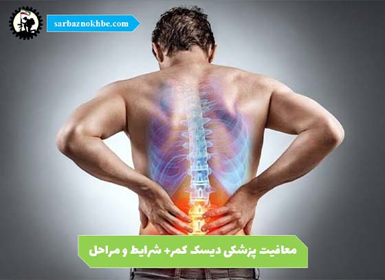 معافیت-پزشکی-دیسک-کمر